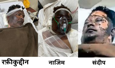 वेल्डिंग कार्य के दौरान विस्फोट से घायल हुए प्रभावितों को मुख्यमंत्री स्वेच्छानुदान से एक-एक लाख रुपये स्वीकृत, कैबिनेट मंत्री काश्यप की पहल पर  प्रभावितों को राशि स्वीकृत